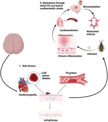 Chagas disease as an underrecognized cause of stroke: implications for public health